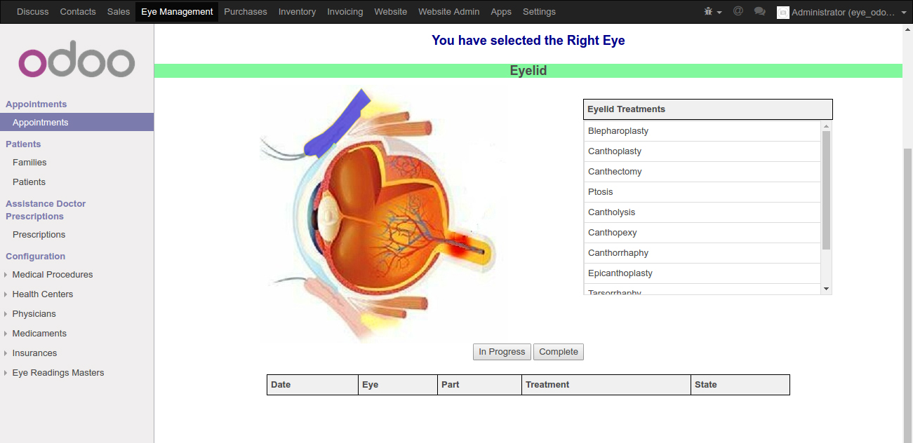 Screenshot of odoo eye clinic managment software